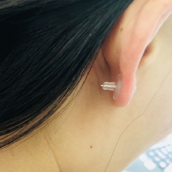 Easy Techniques to Safely Remove Stuck Earring Backs